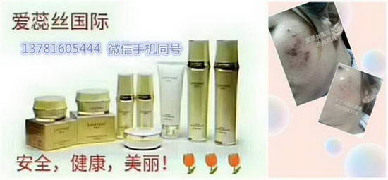 2018年美业什么项目好? 法国爱蕊丝皮肤管理值得投资吗?