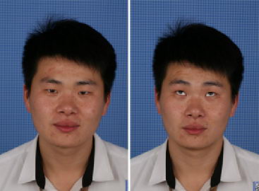 ʿ˫Ƥô ѡȡҽԺ б