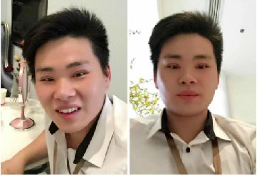 ʿ˫Ƥô ѡȡҽԺ б