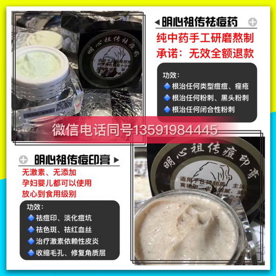 怎么去痘印?有什么好办法?明心祖传创始人阿灵教你