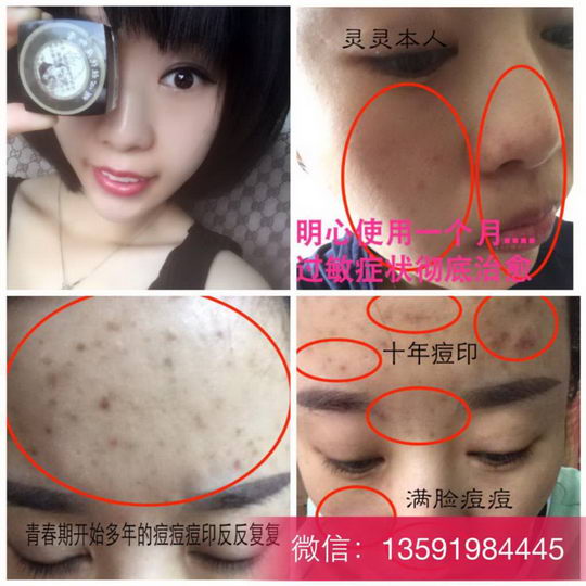 明心祖传批发价多少?内部代理有优惠吗?明心祖传代理分级别吗?