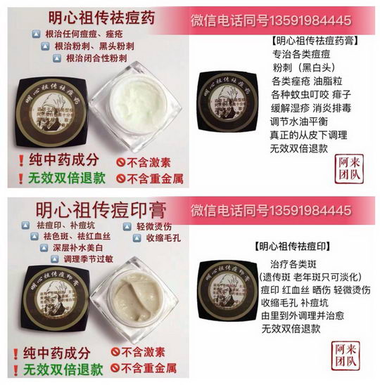 明心祖传批发价多少?内部代理有优惠吗?明心祖传代理分级别吗?