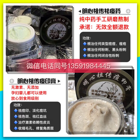 明心祖传批发价多少?内部代理有优惠吗?明心祖传代理分级别吗?