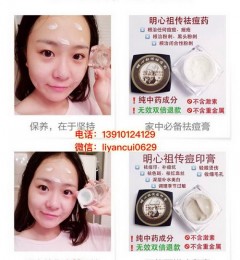 �����洫����ҩ�ɷ֣���Ч�˿��ֵ��ӵ�У�
