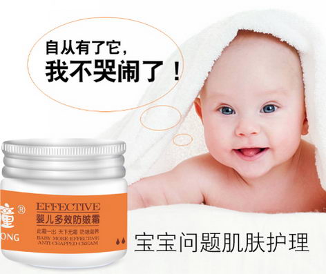 这个冬天,怎么能少了“小顽曈”呢?