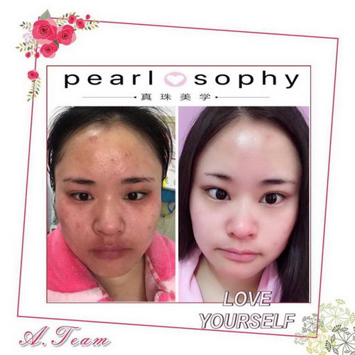 ���ؿ���������ѧ�����۸��Ƕ���,�Ƽ�DE���˴�ʼ�����