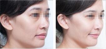 ŮԶںϷάҽԺע䣬Чô