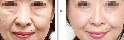 ŮԶںϷάҽԺע䣬Чô