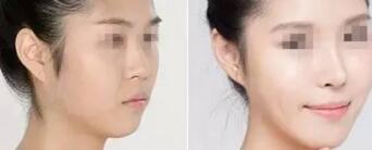 ŮԶںϷάҽԺע䣬Чô