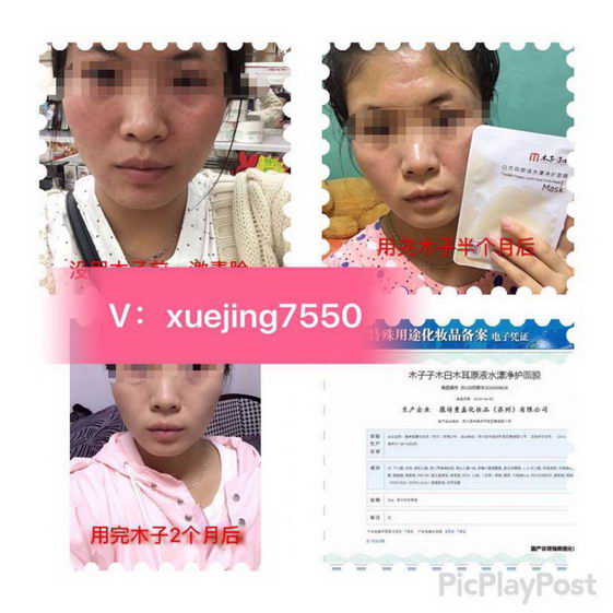 使用木子子木护肤品会不会有副作用?产品有保障吗?