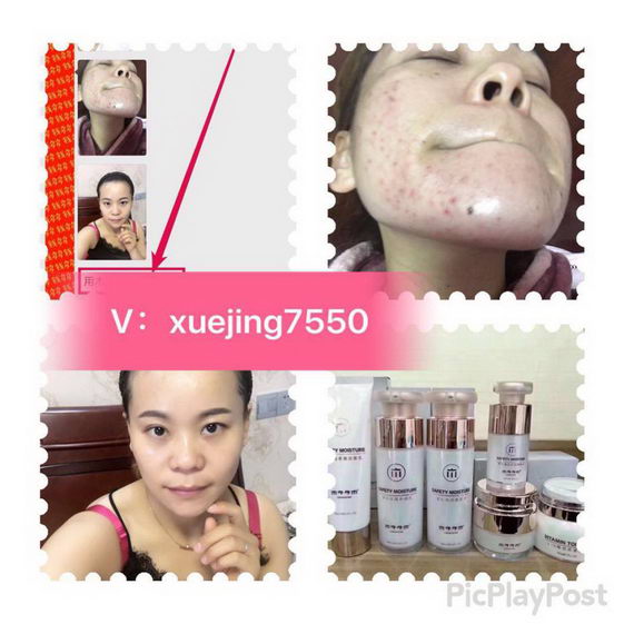 使用木子子木护肤品会不会有副作用?产品有保障吗?