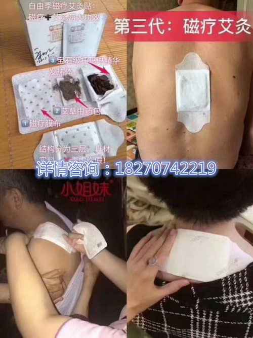 腿麻、腿酸是怎么回事?用九洲福磁疗艾灸贴可以吗?多久见效?