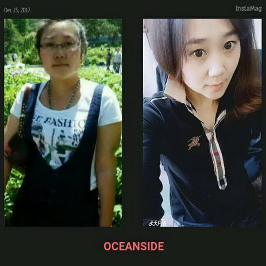 至尊脱脂丸现在招代理吗?门槛低吗?有什么要求?