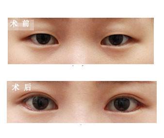 Ϊʲô˫Ƥʧ޸ԽԽ޸-ϲ˫Ƥ޸