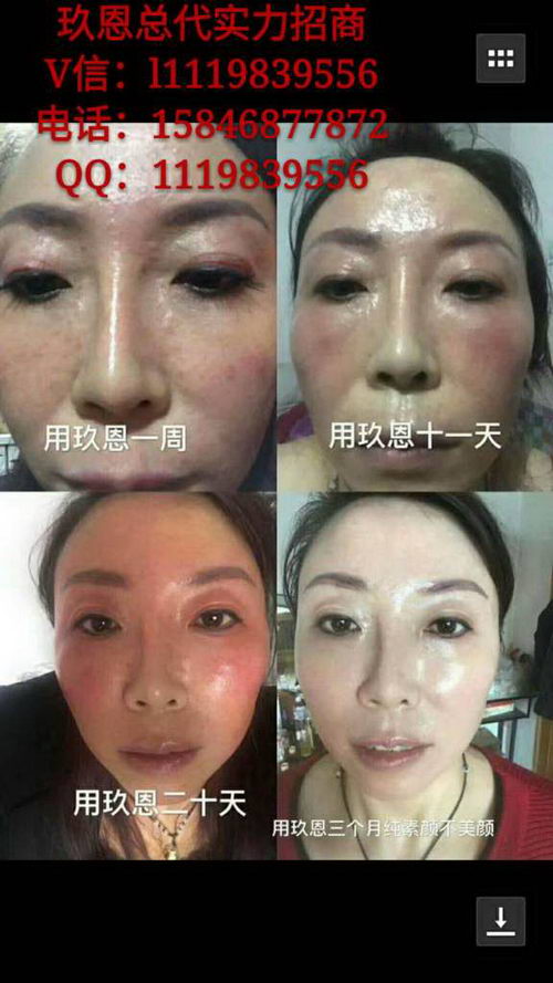 玖恩青春定格原液都有什么功效,多少钱