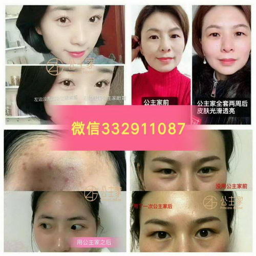 公主家护肤品是纯天然成分,对敏感肌肤没有刺激