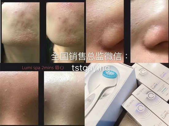 nuskin lumispaϴǺòмܲã