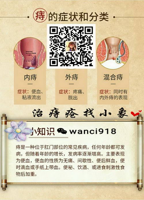 痔疮能自愈吗?主要症状有哪些?婉慈志德舒效果怎么样?