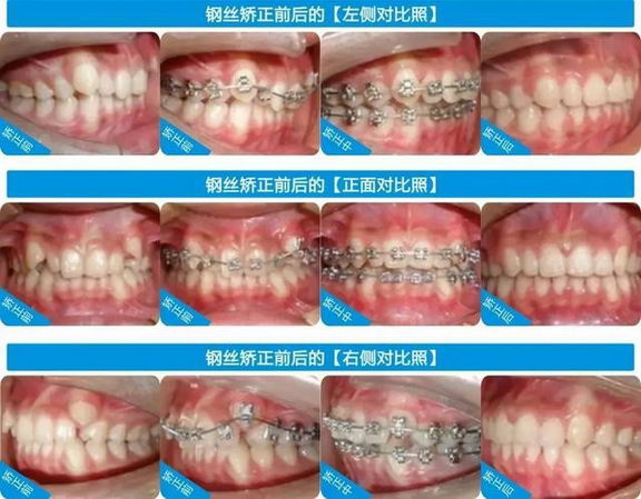 ȷʥǻҽԺϲӭŮڣֱ12000