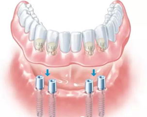 ൺֲļǮǶ٣ŵʿǻ۸