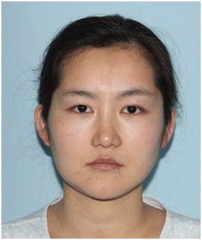 上海美立方谭拯院长肋软骨鼻整形高级研修班开班啦