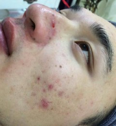 ����DRACNE��Ժ�������ò��ã��¶������