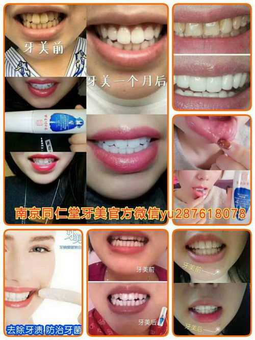 南京同仁堂牙美是什么产品?靠谱吗