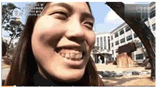 成都牙齿矫正哪个医院哪儿好?对于矫正你到底在怕啥?成都茁悦口腔