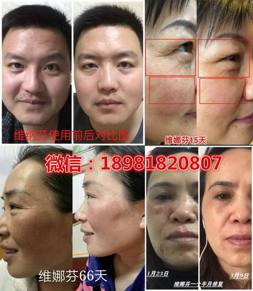 ⶾ˾ʲôãάȷҽ»һʥƷ