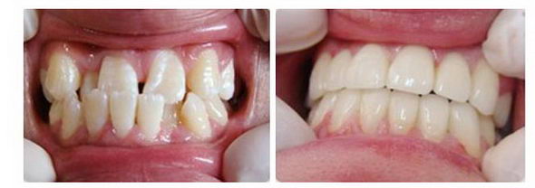 常州牙博士口腔医院医院正规吗 矫正的理想选择