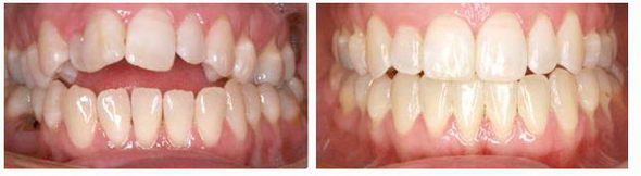 常州牙博士口腔医院医院正规吗 矫正的理想选择