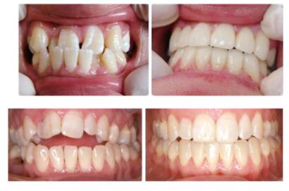 常州牙博士好不好 牙齿健康倡导者