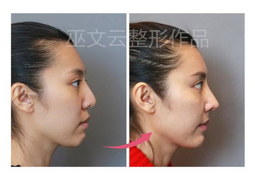 ,Ժ,иǲϽӽ,֯; зǳõԡᷢ; αǼ,ǷǳõĲϡ