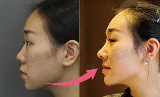 ,Ժ,иǲϽӽ,֯; зǳõԡᷢ; αǼ,ǷǳõĲϡ