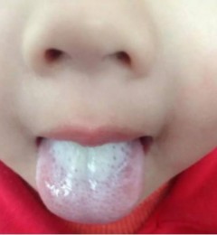 ��̦�Ǻ��ӽ������������ͯ����������̦Ҫ����