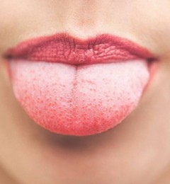 �ɺ��ȸ�Ⱦ���������� ��ͯ��Ҫע����������������