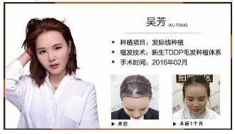 TDDP®ֲЧôֲŴԺ㣡 