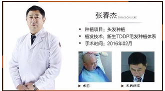 TDDP®ֲЧôֲŴԺ㣡 