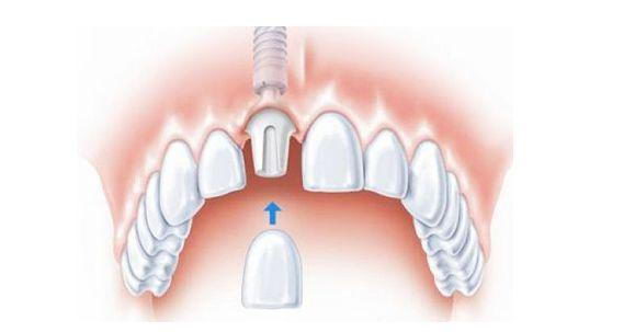 ɶÿǻշѹ  ƽշѱ㽡