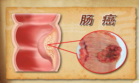 ͬʱֱ  ݶҽԺרҽֱ