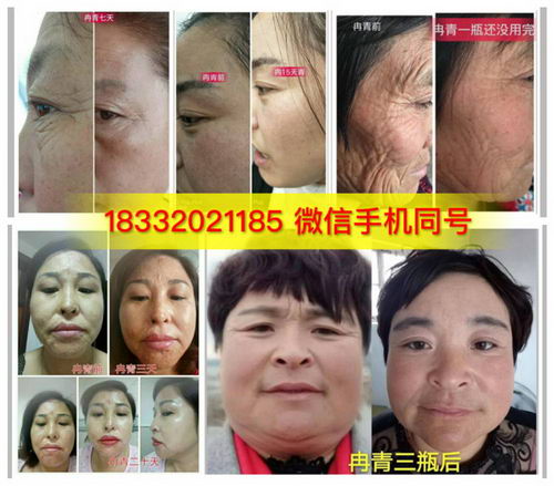 ȽഺԭҺʲôЧ|ʲôɷ