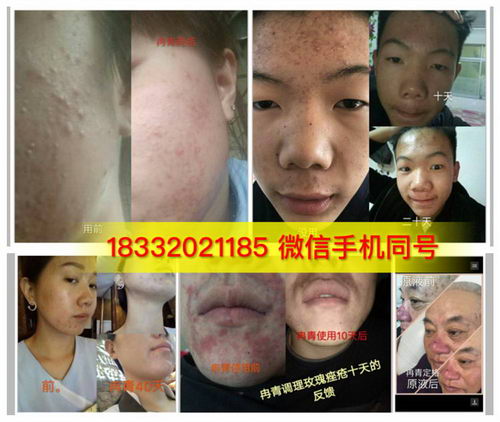 ȽഺԭҺʲôЧ|ʲôɷ