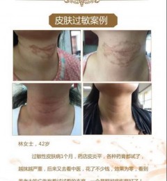 ��ͷ��������ҵ���Ƥ�����ĵط� ��ͷ����̫�޷���