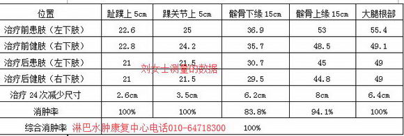 ƶҽԺӹȫ˫ܰˮ׼۸ ԼͷΪ׼