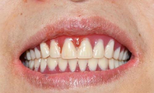 ݿǻҽԺݱֲʵ40Ů˵