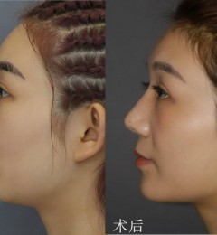 ������������ע��¡��������ô���������ļ۸�