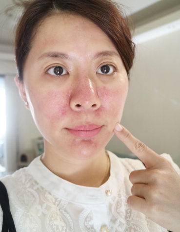 专业美肤品牌心得LOVEISDERMA爱斯德玛