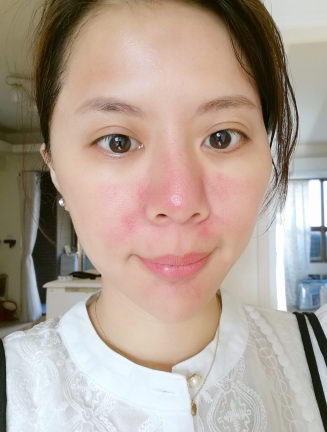 专业美肤品牌心得LOVEISDERMA爱斯德玛