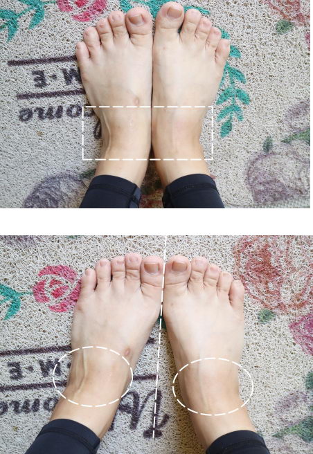 专业美肤品牌心得LOVEISDERMA爱斯德玛