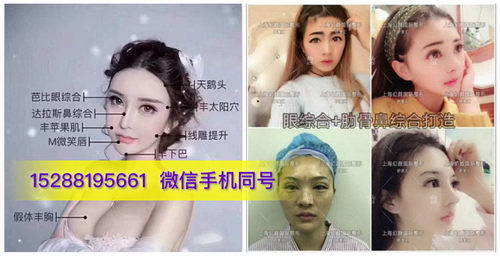 肋骨鼻综合打造需要多少钱|哪个医院好|上海幻颜国际